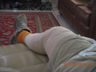 after knee operation