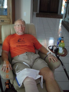 after knee operation + Adam