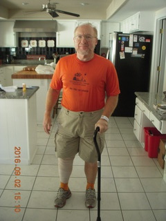 after knee operation + Adam walking with cane