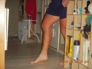 after knee operation + Adam walking with cane