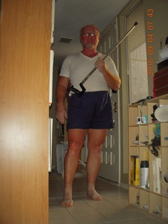 two days after my knee surgery