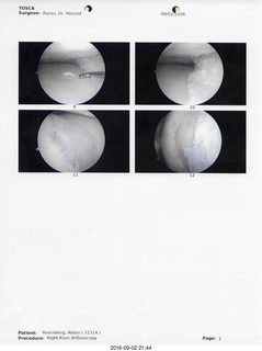 two days after my knee surgery