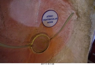 Philadelphia - The Franklin Institute - the Heart exhibit