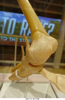 two days after my knee surgery