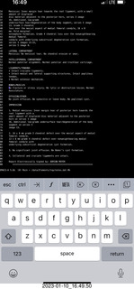 two days after my knee surgery