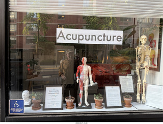 New York City - accupunture